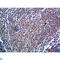 Endoglin antibody, LS-C813847, Lifespan Biosciences, Immunohistochemistry paraffin image 