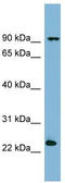 VPS29 Retromer Complex Component antibody, TA345052, Origene, Western Blot image 