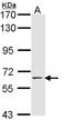 Selectin E antibody, LS-C109540, Lifespan Biosciences, Western Blot image 