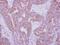 Interleukin 10 Receptor Subunit Alpha antibody, GTX102731, GeneTex, Immunohistochemistry paraffin image 
