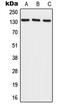 RecQ Like Helicase 4 antibody, GTX55183, GeneTex, Western Blot image 