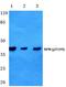 Nucleophosmin 1 antibody, A00450T199-1, Boster Biological Technology, Western Blot image 