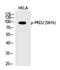 Protein Kinase D2 antibody, PA5-40221, Invitrogen Antibodies, Western Blot image 