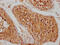 Heat Shock Protein Family A (Hsp70) Member 1 Like antibody, CSB-PA010823HA01HU, Cusabio, Immunohistochemistry paraffin image 