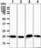 Neuronal Calcium Sensor 1 antibody, GTX57688, GeneTex, Western Blot image 