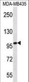 Myosin IC antibody, LS-C164713, Lifespan Biosciences, Western Blot image 