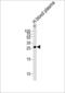 Complement C1q B Chain antibody, LS-C168047, Lifespan Biosciences, Western Blot image 