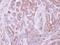 TEK Receptor Tyrosine Kinase antibody, GTX107505, GeneTex, Immunohistochemistry paraffin image 