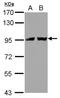 Transportin 2 antibody, NBP2-20676, Novus Biologicals, Western Blot image 