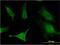 Solute Carrier Family 6 Member 16 antibody, MA5-21753, Invitrogen Antibodies, Immunofluorescence image 