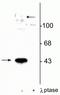 Mitogen-Activated Protein Kinase Kinase 1 antibody, P00292-2, Boster Biological Technology, Western Blot image 