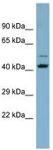 Zinc Finger Protein 506 antibody, TA342456, Origene, Western Blot image 