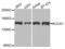 Rho Associated Coiled-Coil Containing Protein Kinase 1 antibody, AHP2520, Bio-Rad (formerly AbD Serotec) , Western Blot image 