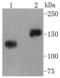Complement C3d Receptor 2 antibody, A01632-4, Boster Biological Technology, Western Blot image 