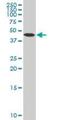 Arrestin Beta 2 antibody, H00000409-M06, Novus Biologicals, Western Blot image 