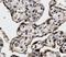 Platelet Derived Growth Factor Receptor Alpha antibody, NB110-60969, Novus Biologicals, Immunohistochemistry paraffin image 