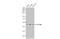 Dolichyl-Diphosphooligosaccharide--Protein Glycosyltransferase Non-Catalytic Subunit antibody, GTX102211, GeneTex, Western Blot image 