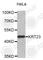 Keratin, type I cytoskeletal 23 antibody, A2664, ABclonal Technology, Western Blot image 