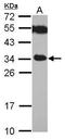 Toll Like Receptor Adaptor Molecule 2 antibody, GTX112785, GeneTex, Western Blot image 