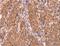 Abl Interactor 1 antibody, LS-C402089, Lifespan Biosciences, Immunohistochemistry paraffin image 