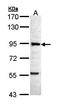 6-Phosphofructo-2-Kinase/Fructose-2,6-Biphosphatase 1 antibody, orb73897, Biorbyt, Western Blot image 