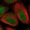 Calsequestrin-2 antibody, NBP1-87304, Novus Biologicals, Immunofluorescence image 