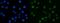 Casein Kinase 2 Alpha 1 antibody, A04722-1, Boster Biological Technology, Immunofluorescence image 