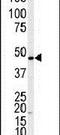 Adrenoceptor Beta 2 antibody, PA5-14119, Invitrogen Antibodies, Western Blot image 