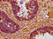Cyclin D2 antibody, LS-C375408, Lifespan Biosciences, Immunohistochemistry paraffin image 