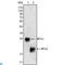 Myosin Light Chain 2 antibody, LS-C812816, Lifespan Biosciences, Western Blot image 