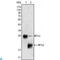 Myosin regulatory light chain 2, ventricular/cardiac muscle isoform antibody, LS-C812816, Lifespan Biosciences, Western Blot image 