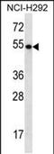 TBC1 Domain Family Member 3F antibody, PA5-48350, Invitrogen Antibodies, Western Blot image 