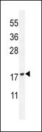 Group IID secretory phospholipase A2 antibody, 55-671, ProSci, Western Blot image 