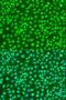 Inhibitor Of Nuclear Factor Kappa B Kinase Subunit Beta antibody, LS-C746752, Lifespan Biosciences, Immunofluorescence image 