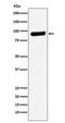 Ribonucleotide Reductase Catalytic Subunit M1 antibody, M01764, Boster Biological Technology, Western Blot image 