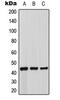 Adrenoceptor Beta 3 antibody, MBS8220053, MyBioSource, Western Blot image 