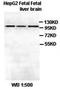 Catenin Alpha 2 antibody, orb77050, Biorbyt, Western Blot image 