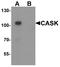 Calcium/Calmodulin Dependent Serine Protein Kinase antibody, A02468, Boster Biological Technology, Western Blot image 