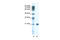 SSX Family Member 2B antibody, 28-727, ProSci, Enzyme Linked Immunosorbent Assay image 