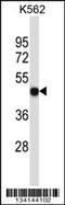 Purinergic Receptor P2X 5 antibody, 57-451, ProSci, Western Blot image 