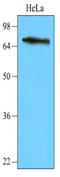 Nuclear Receptor Binding SET Domain Protein 3 antibody, LS-C93773, Lifespan Biosciences, Western Blot image 