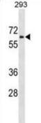 Zinc Finger HIT-Type Containing 6 antibody, abx029661, Abbexa, Western Blot image 