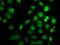 Down-Regulator Of Transcription 1 antibody, GTX55597, GeneTex, Immunofluorescence image 