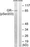 Nuclear Receptor Subfamily 3 Group C Member 1 antibody, abx012578, Abbexa, Western Blot image 