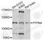 Protein Tyrosine Phosphatase Non-Receptor Type 4 antibody, A4061, ABclonal Technology, Western Blot image 