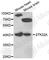Serine/Threonine Kinase 32A antibody, A7613, ABclonal Technology, Western Blot image 