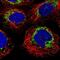 Metastasis-associated in colon cancer protein 1 antibody, PA5-56163, Invitrogen Antibodies, Immunofluorescence image 