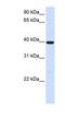 Alcohol Dehydrogenase 1A (Class I), Alpha Polypeptide antibody, NBP1-57672, Novus Biologicals, Western Blot image 