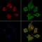 Ceramide Synthase 2 antibody, GTX02887, GeneTex, Immunofluorescence image 