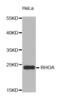 Ras Homolog Family Member A antibody, abx004527, Abbexa, Western Blot image 